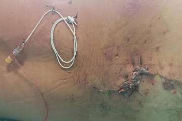 Heridas recibidas por Manuel Artiles/TA y C7.